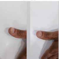 1000160141